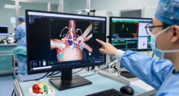 Exploring Clinical Surgery Through NVIDIA Cosmos3-H-Dreams